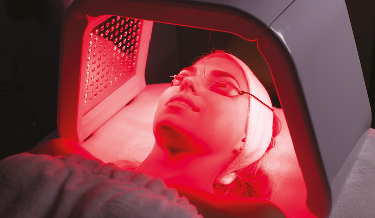 red light therapy for burns