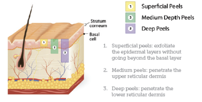 Chemical Peel Strength Chart