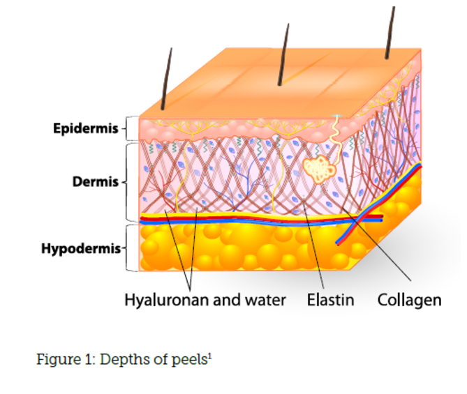 Case Study: Administering a TCA peel - Aesthetics