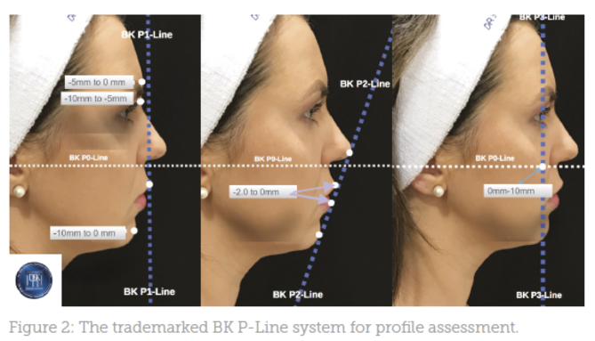 Profile Assessment - Aesthetics